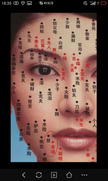 好吃痣长在哪里