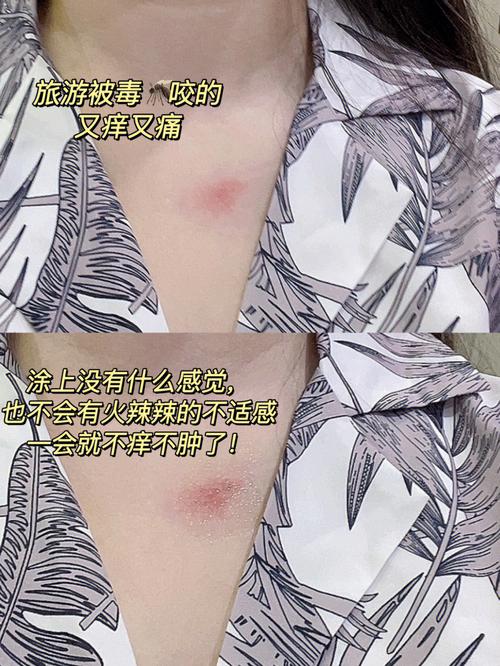 出门前见血是什么征兆