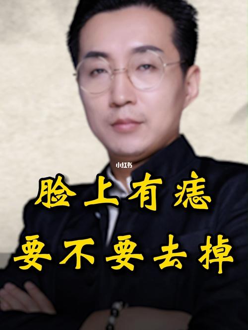 男人眉心长有美人痣好不好