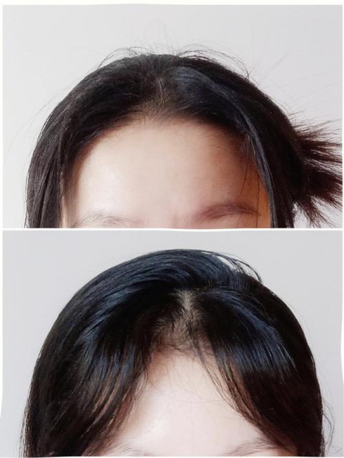 前额发际线有漩涡的人