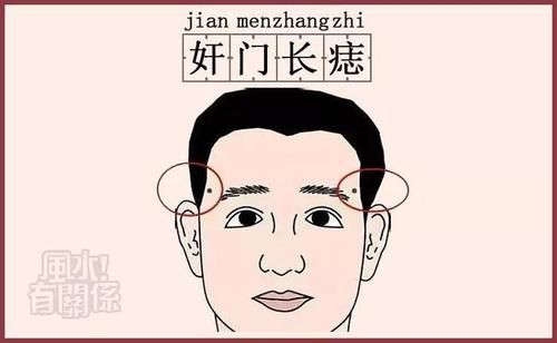 男人右奸门有痣一定不好吗