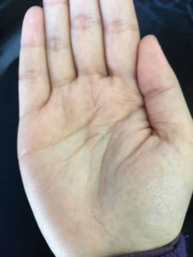 智慧线中间折了一下