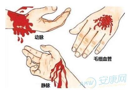 梦见自己受伤流了很多血是什么意思