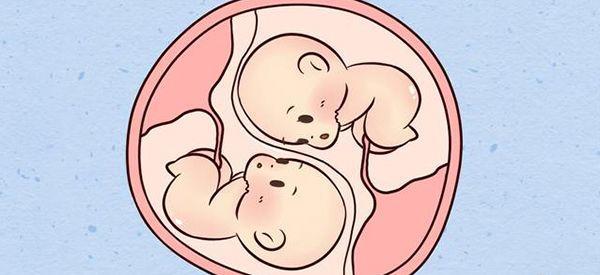 梦见老婆生了双胞胎