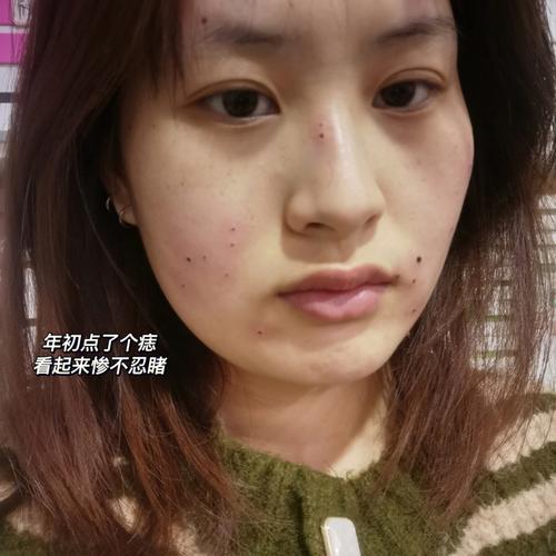 嘴巴边有痣的人如何改变自己的命运