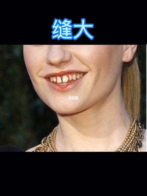 女人牙缝大面相说法