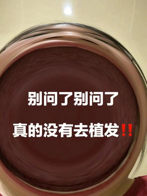 做梦梦见狗追人,别方!吉凶指数有88
