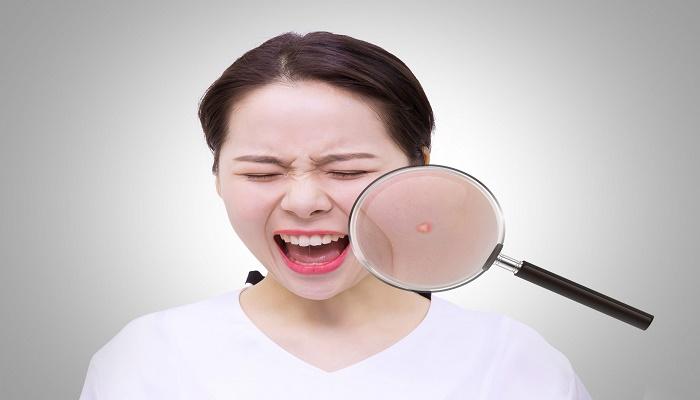 梦见挤痘是什么意思