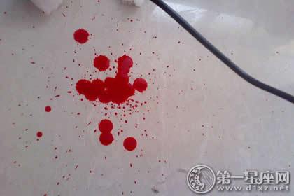 梦见血滴在地上何解?财位在东南方