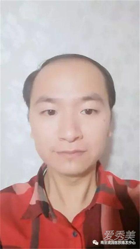 梦见秃头的男子是什么意思