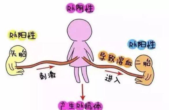 为什么rh阴性第一胎不会溶血