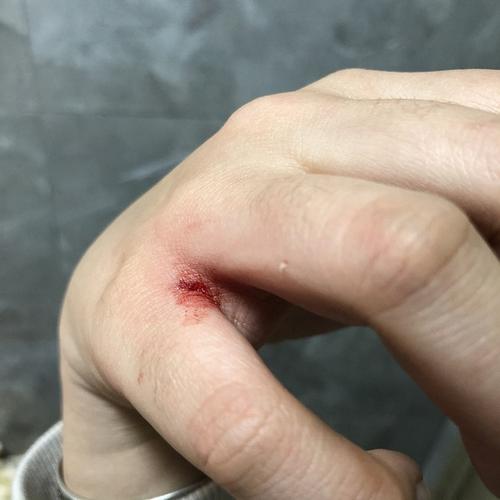 梦见被猫咬伤出血