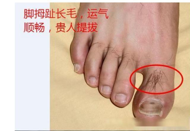 富贵毛的位置在哪