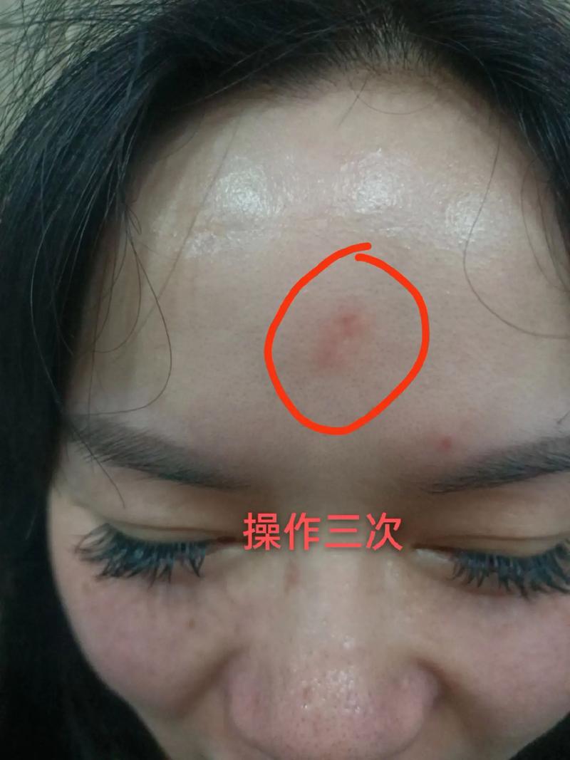 身体有疤痕会影响财运吗