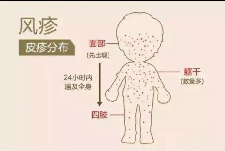 梦见风疹周公解梦,梦见风疹是什么意思?