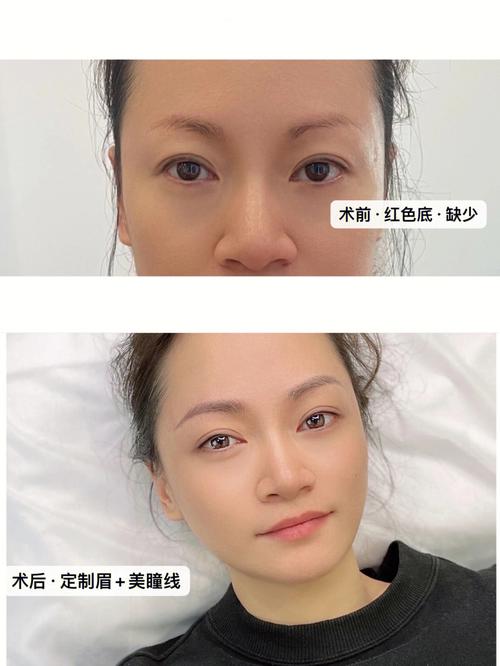 女人眉毛稀少好不好