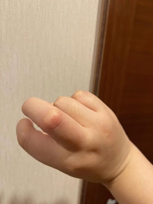 梦到一直被猫咬手但是没流血有什么征兆