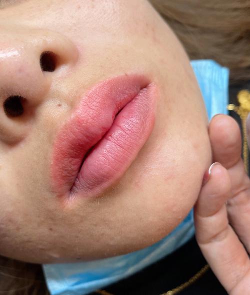 女生嘴巴大好不好