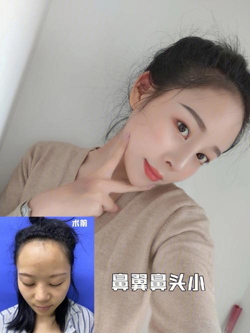 鼻梁翘的人好不好