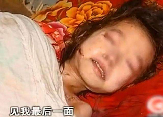 梦见小孩生蛆