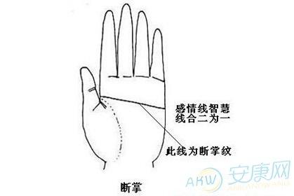 解析:什么叫做通关手?