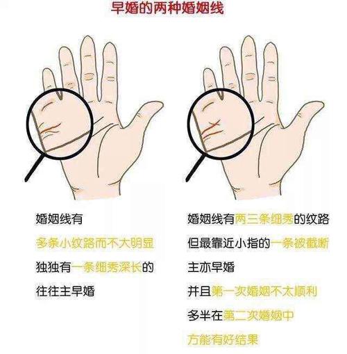 没有婚姻线怎么办会单身一辈子吗