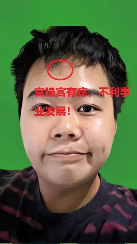 法令纹上的痣代表什么