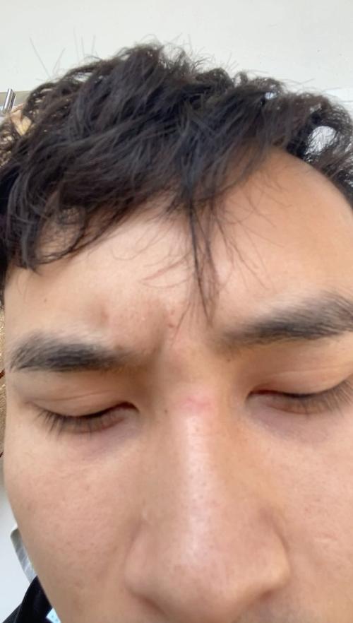 山根有疤的男人好不好