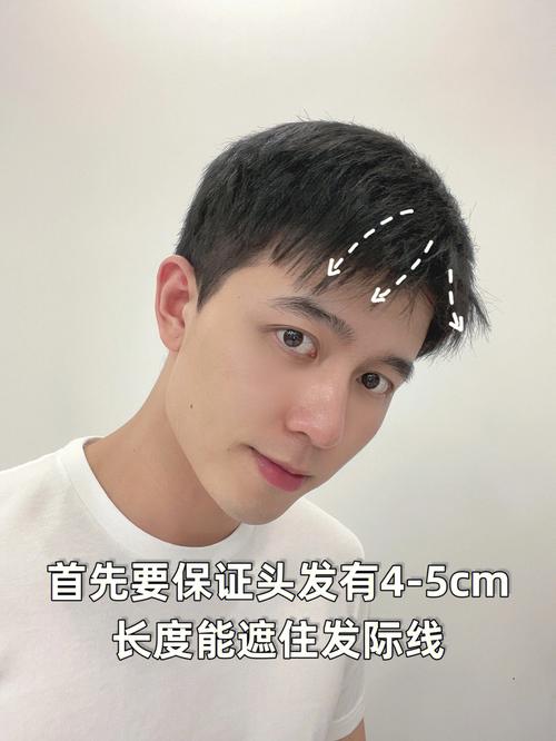 男人发际线高了好还是低了好