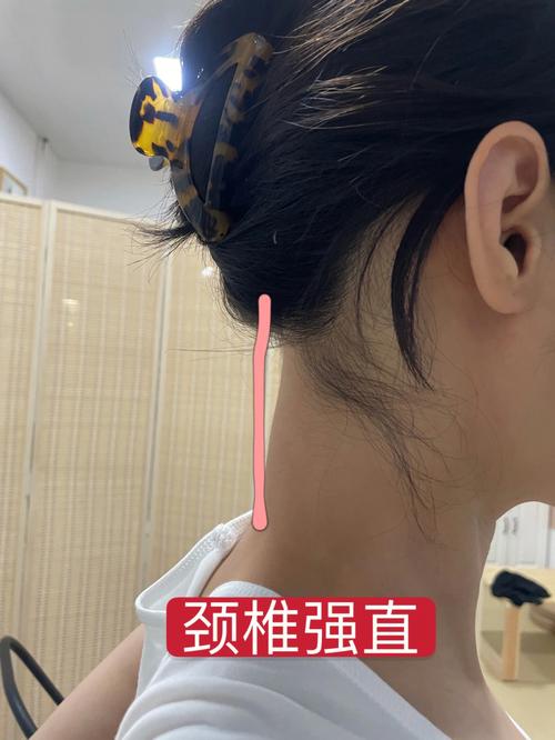 梦见颈项周公解梦,梦见颈项是什么意思?