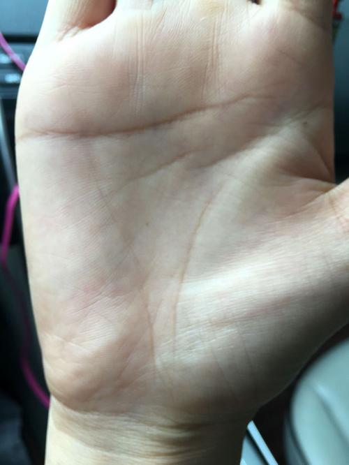 女生右手中间那条线断了