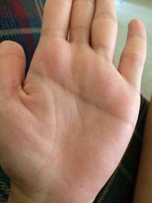 双手断掌的女人