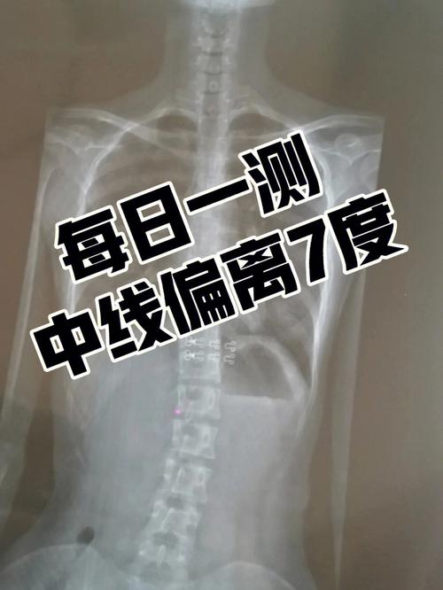 女生直弯测试