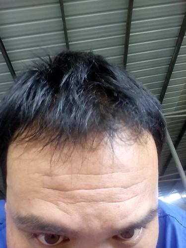 额头长皱纹的男人