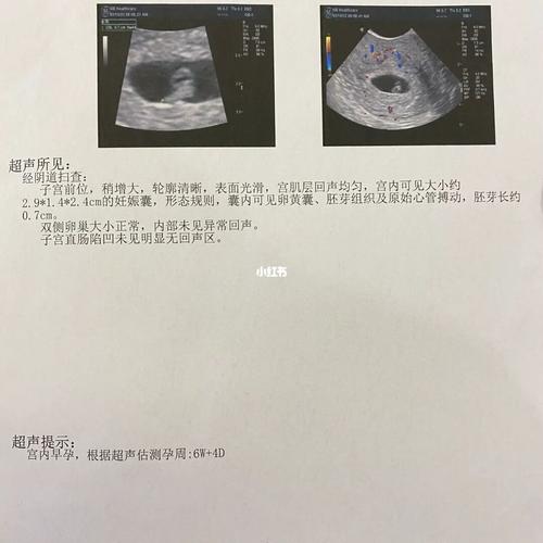 本命年意外怀孕好不好