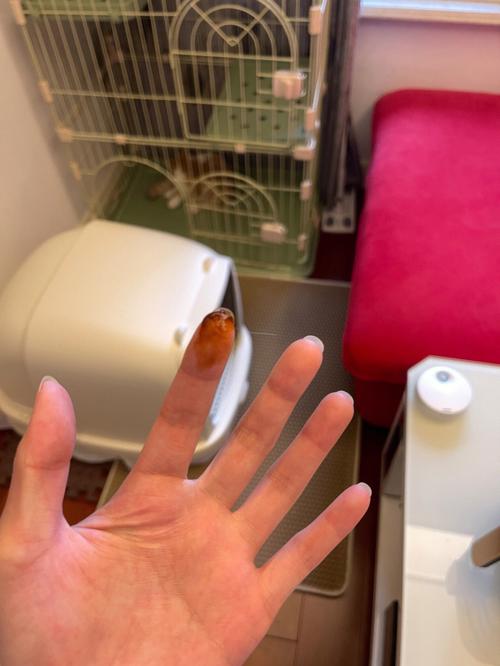 梦见屎粘手上