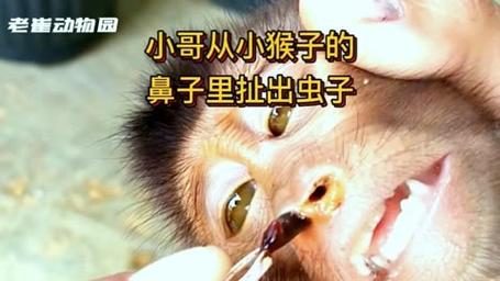 梦见鼻子有虫子