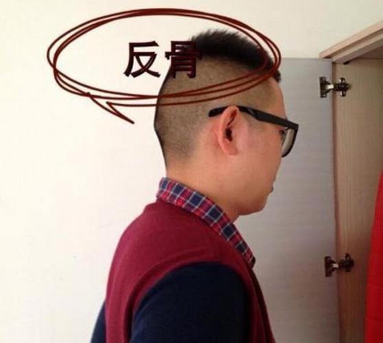 后脑勺有凸起的骨头命运
