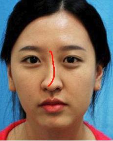 鼻梁歪、夫运差的女人面相分析