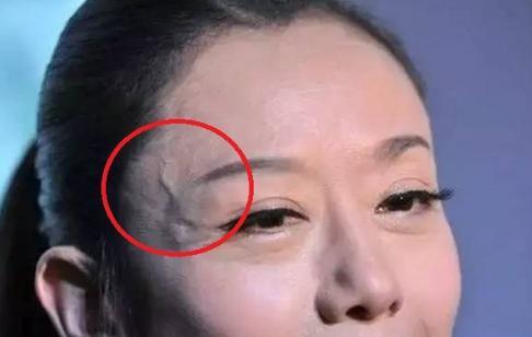女人鼻头中间有青筋是什么原因,青筋面相分析