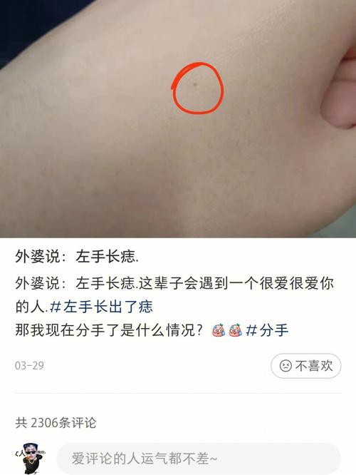 左手腕长痣代表什么女