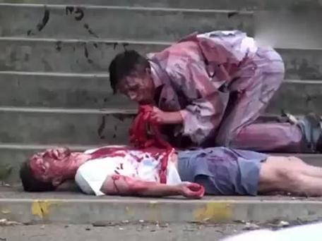 梦见僵尸咬我大腿