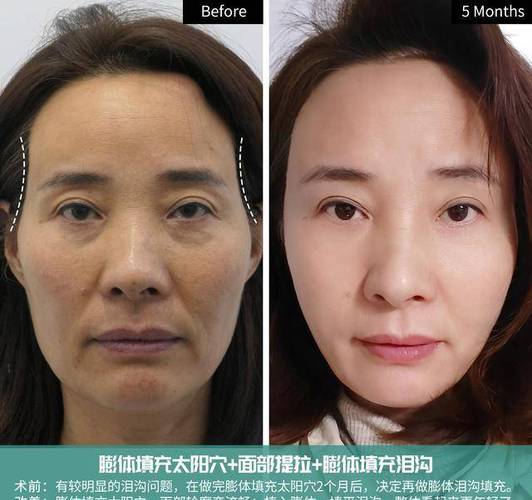 颧骨凹陷的女人毫无人情味吗
