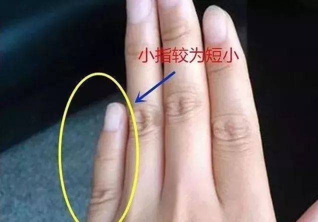 小拇指短的男人有福气