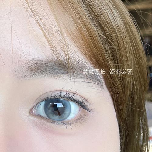 梦见眼睛受伤,梦见眼睛有灰尘怎么回事