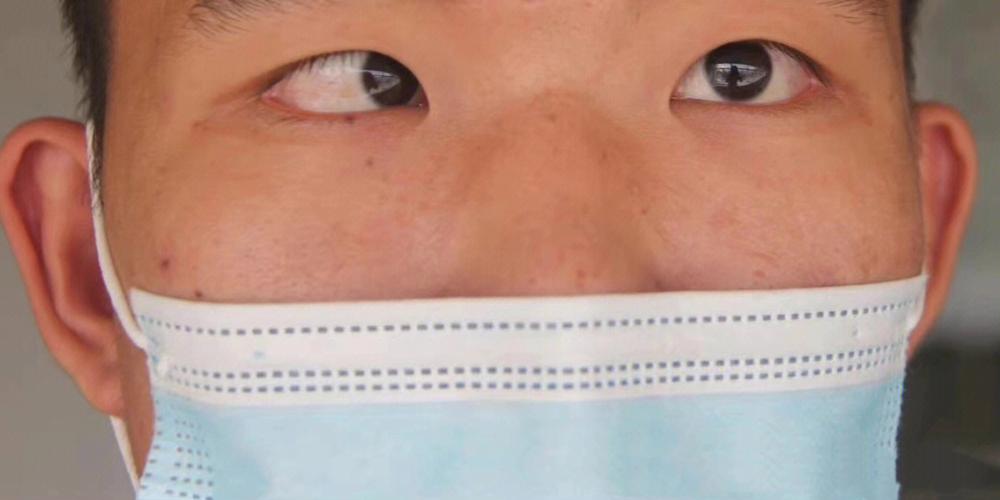 眼睛斜视的人容易对别人怀恨在心吗
