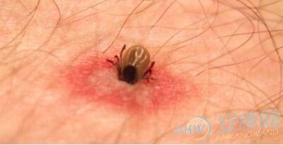 梦到虫子钻到皮肤里还把它扯出来了好不好