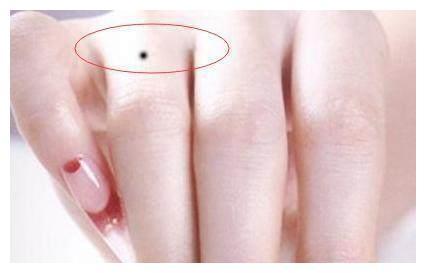 女人少见的极富贵痣手
