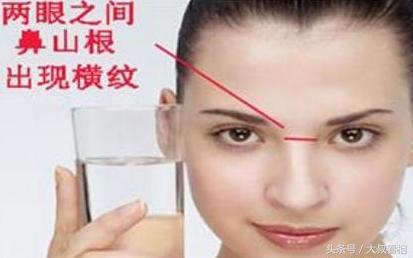 鼻根有横纹代表什么,鼻子有横纹有何说法