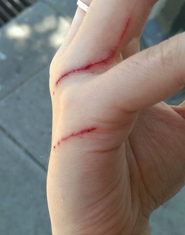梦见被猫抓伤出血